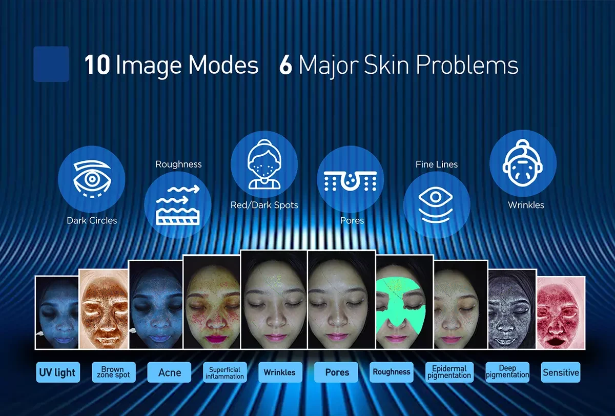 ViewSkin Analyzer Machine ViewSkin Analyzer Machine