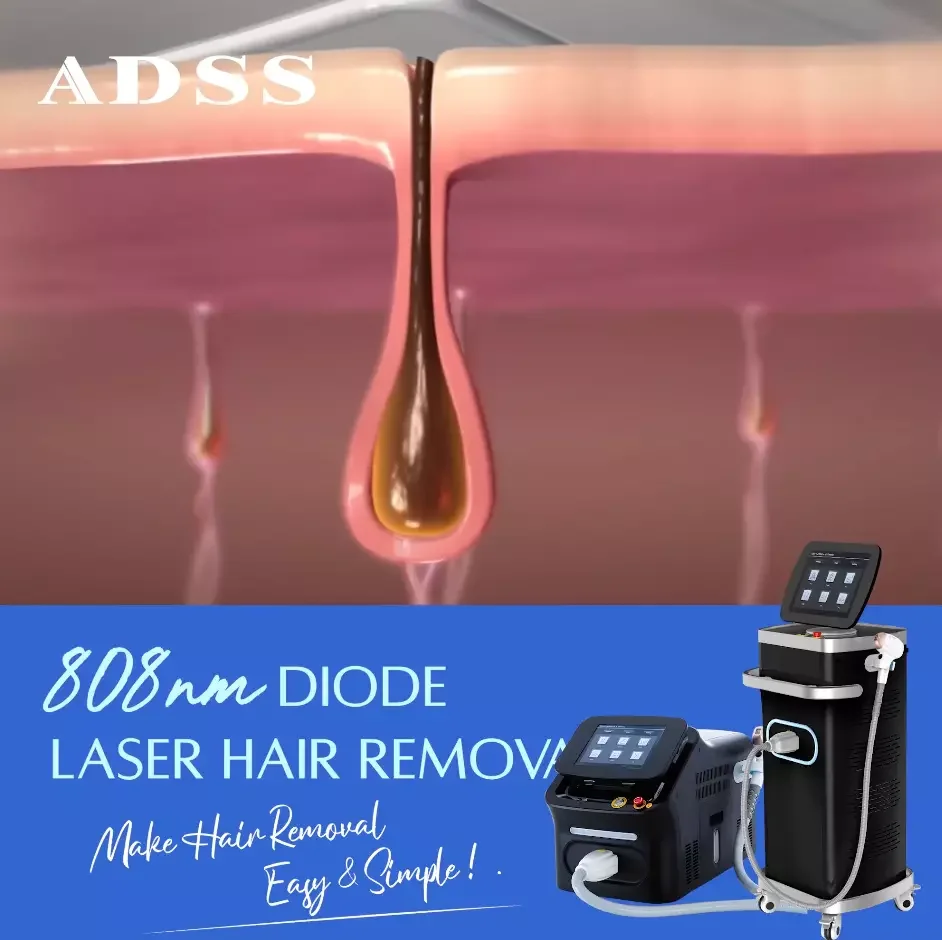 5 Million Shots 808 Diode Laser Hair Removal Machine - konmison