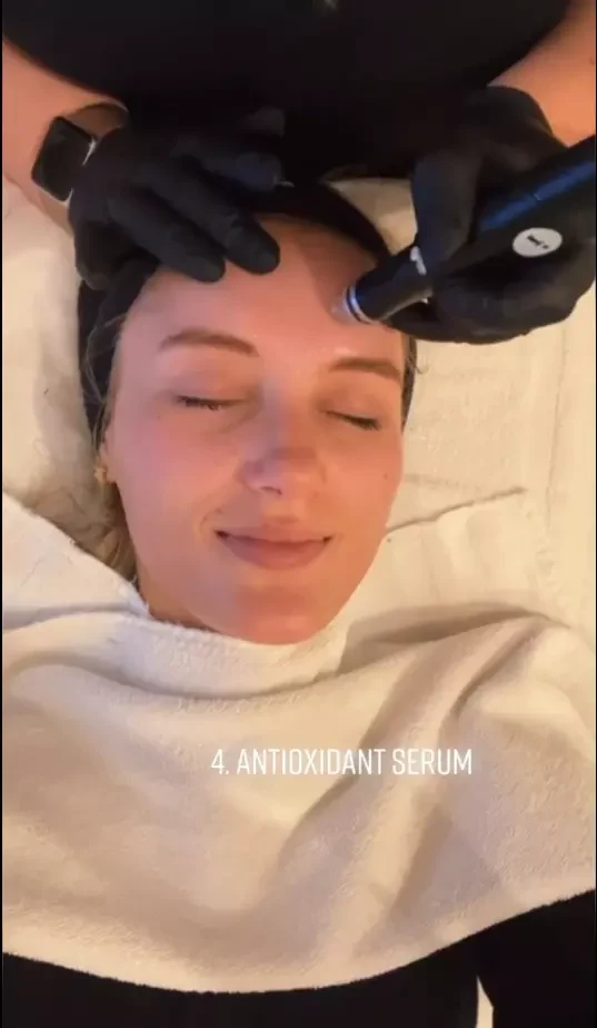 Hydrafacial Benefits, Would You Get This Treatment?