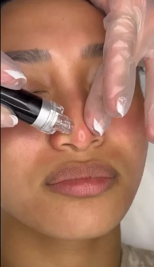 Nothing Feels Better Than A Hydrofacial