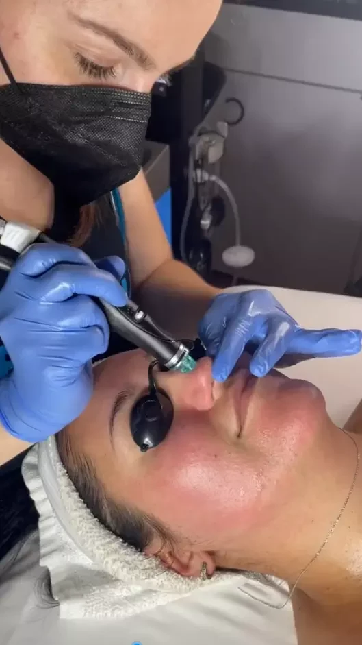 Hydrafacials Can Help You Live A Better Life