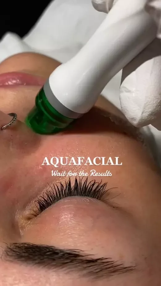 Experience The Ultimate Hydrafacial Treatment And Unveil Your Radiant Skin Today