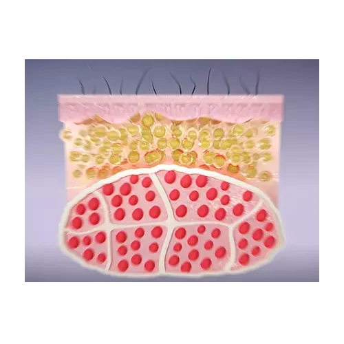 What is the EM contouring What is the EM contouring
