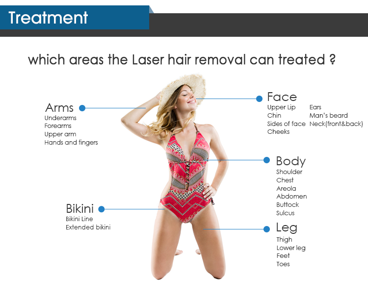 Advantages of diode Laser Hair Removal Machine