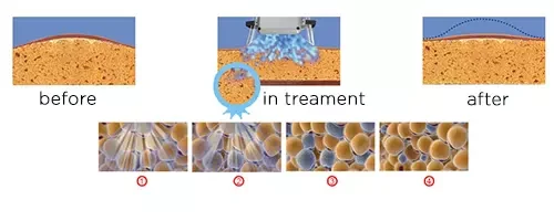 Cool Slimming Machine Theory