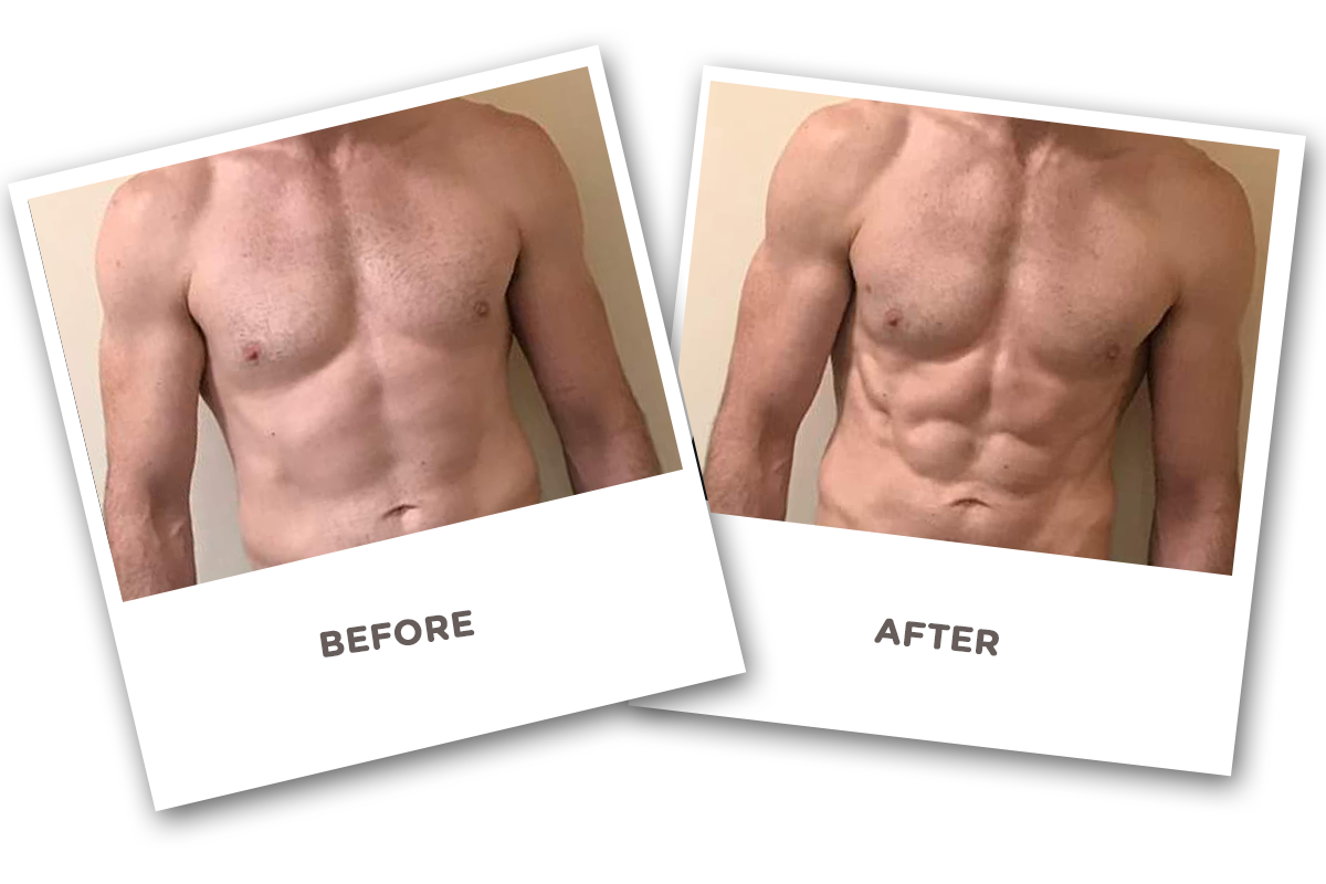 Electrical Muscle Stimulation Before And After