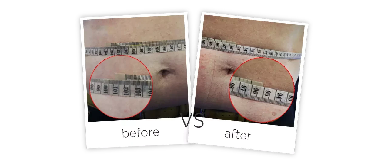 Laser Shape Body Slimming System Treatment results