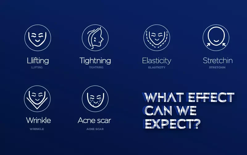 Microneedling RF