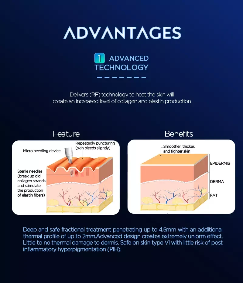Microneedling RF