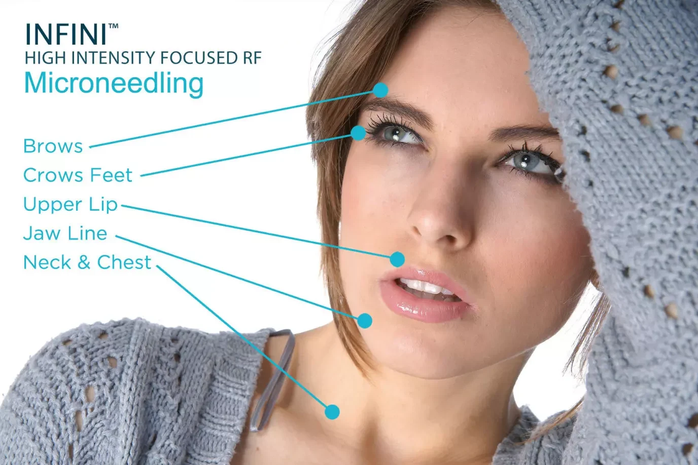 Microneedling RF Function