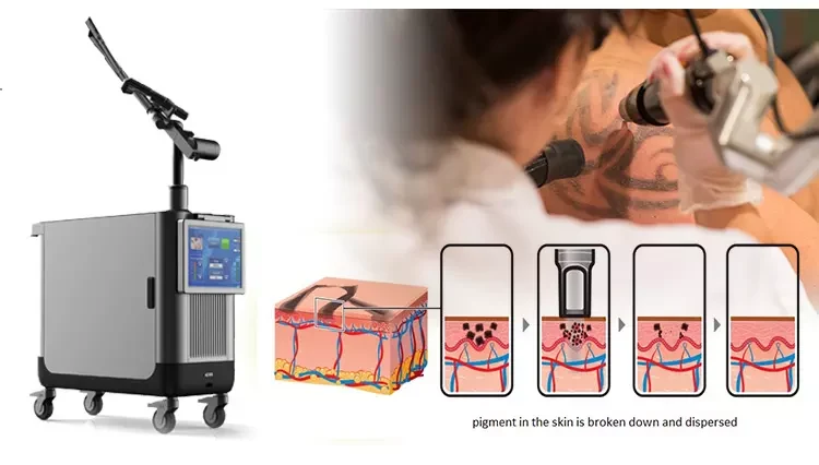 Picosecond Laser Machine images