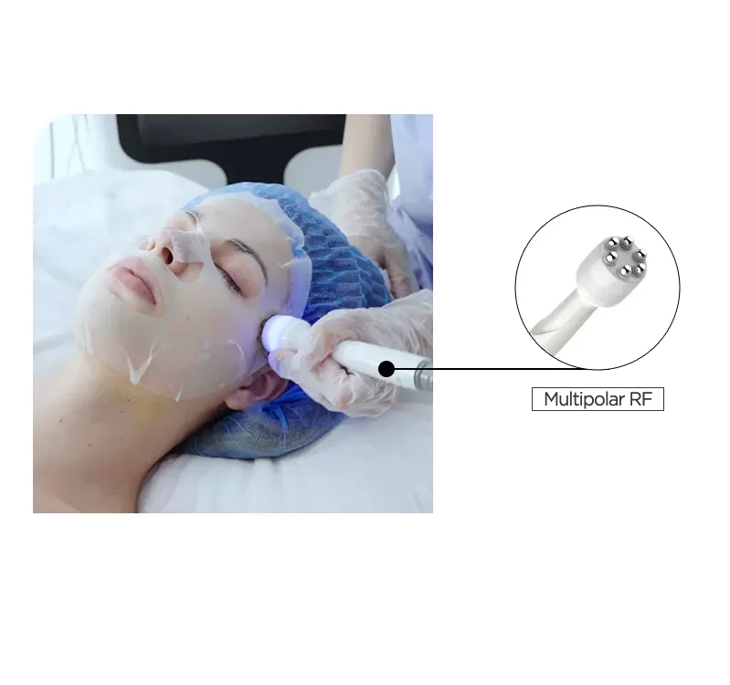 Aqua Facial - Radio Frequency Technologies