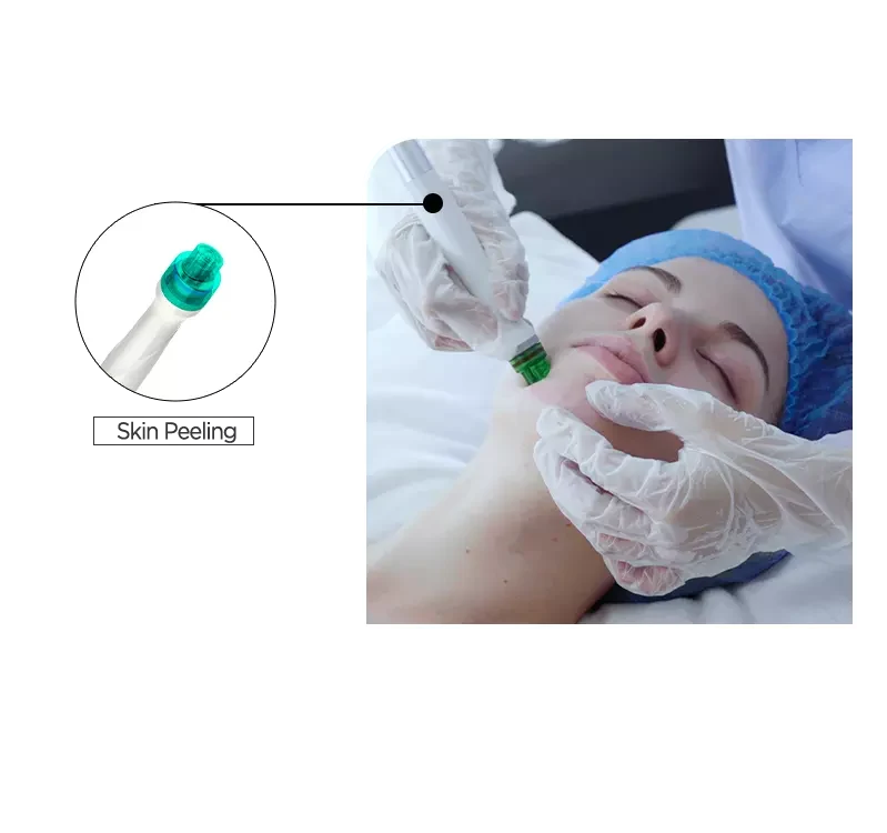 Aqua Facial - Hydro Peel Technologies