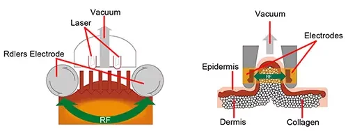 Vacuum Shaping VS++ Theory