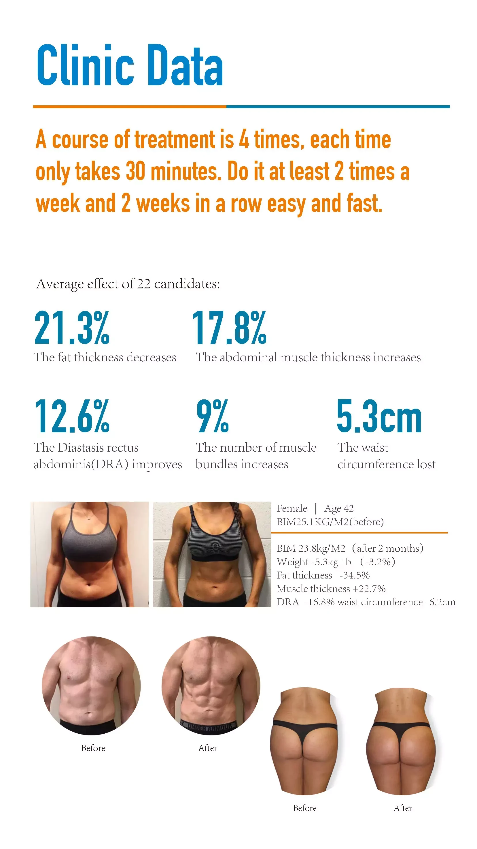 EM-Contouring RF Machine PDF