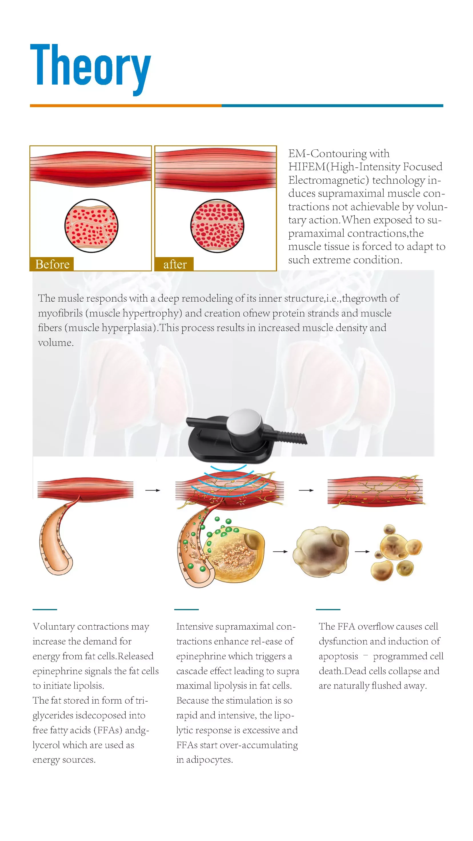 Four-handles EM-Contouring Machine