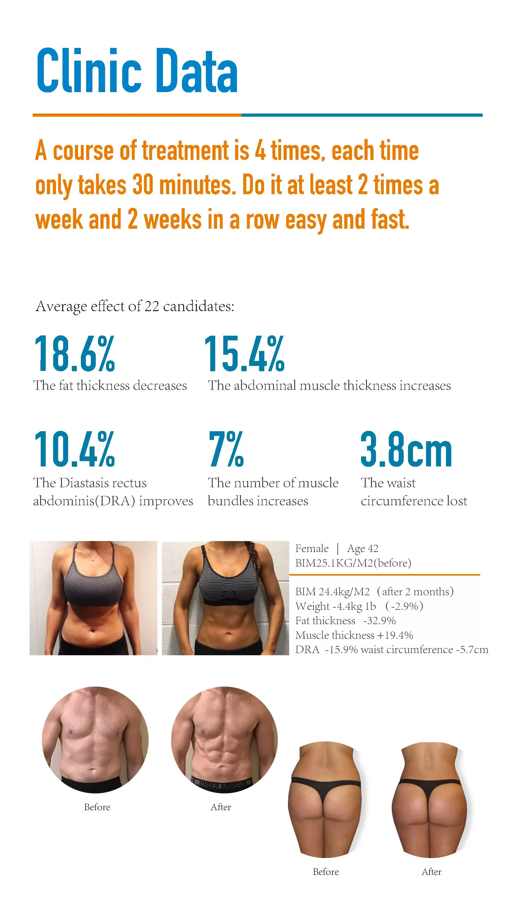 Four-handles EM-Contouring Machine
