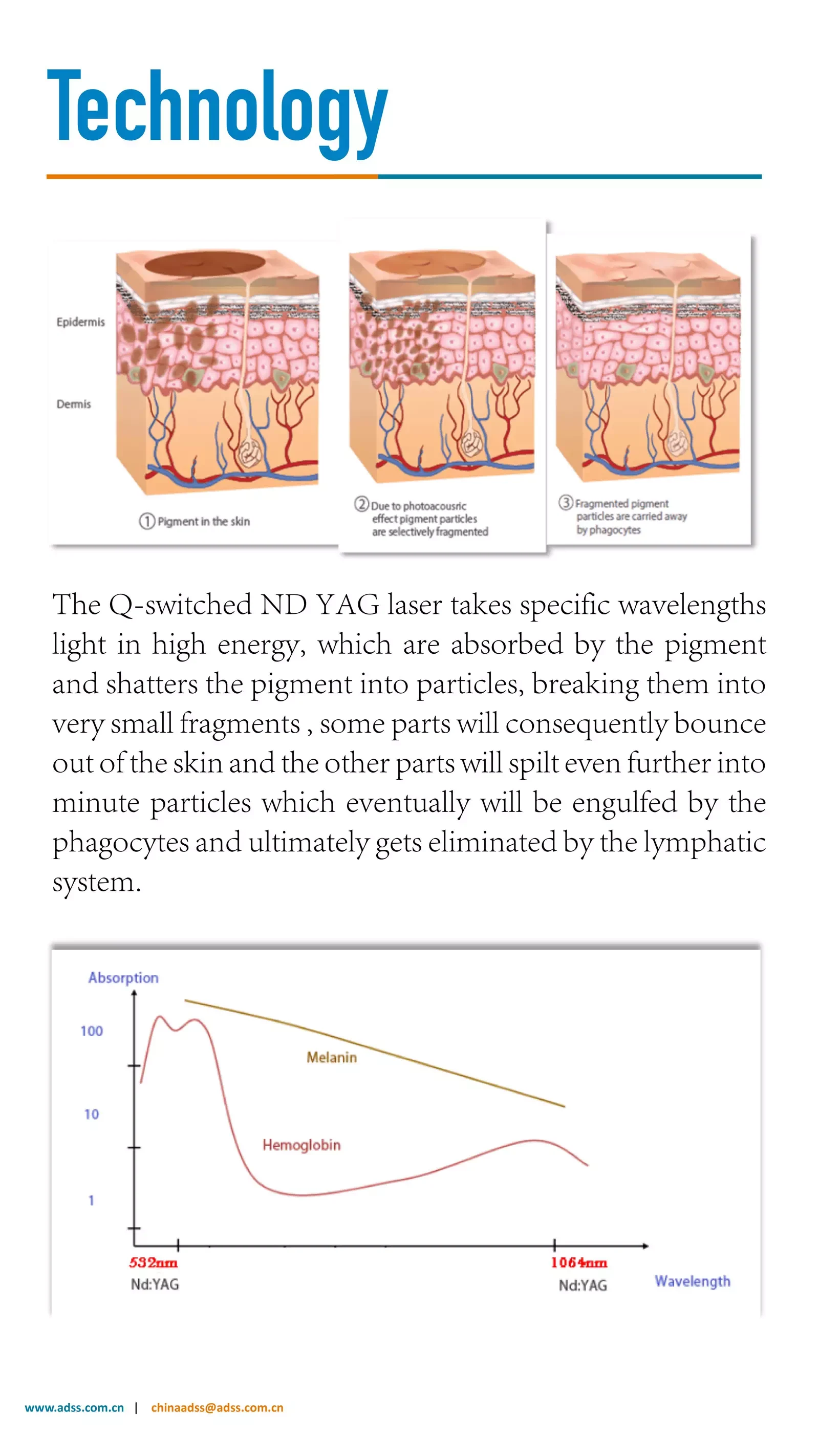ND YAG Laser Spot Removal System 
 PDF Download