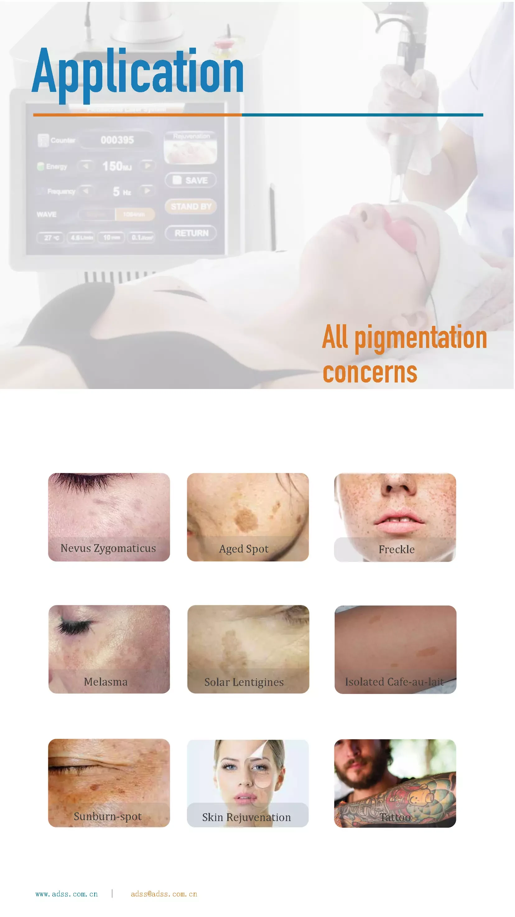 Picosecond Laser Removal Tattoo Treatment Machine PDF Download