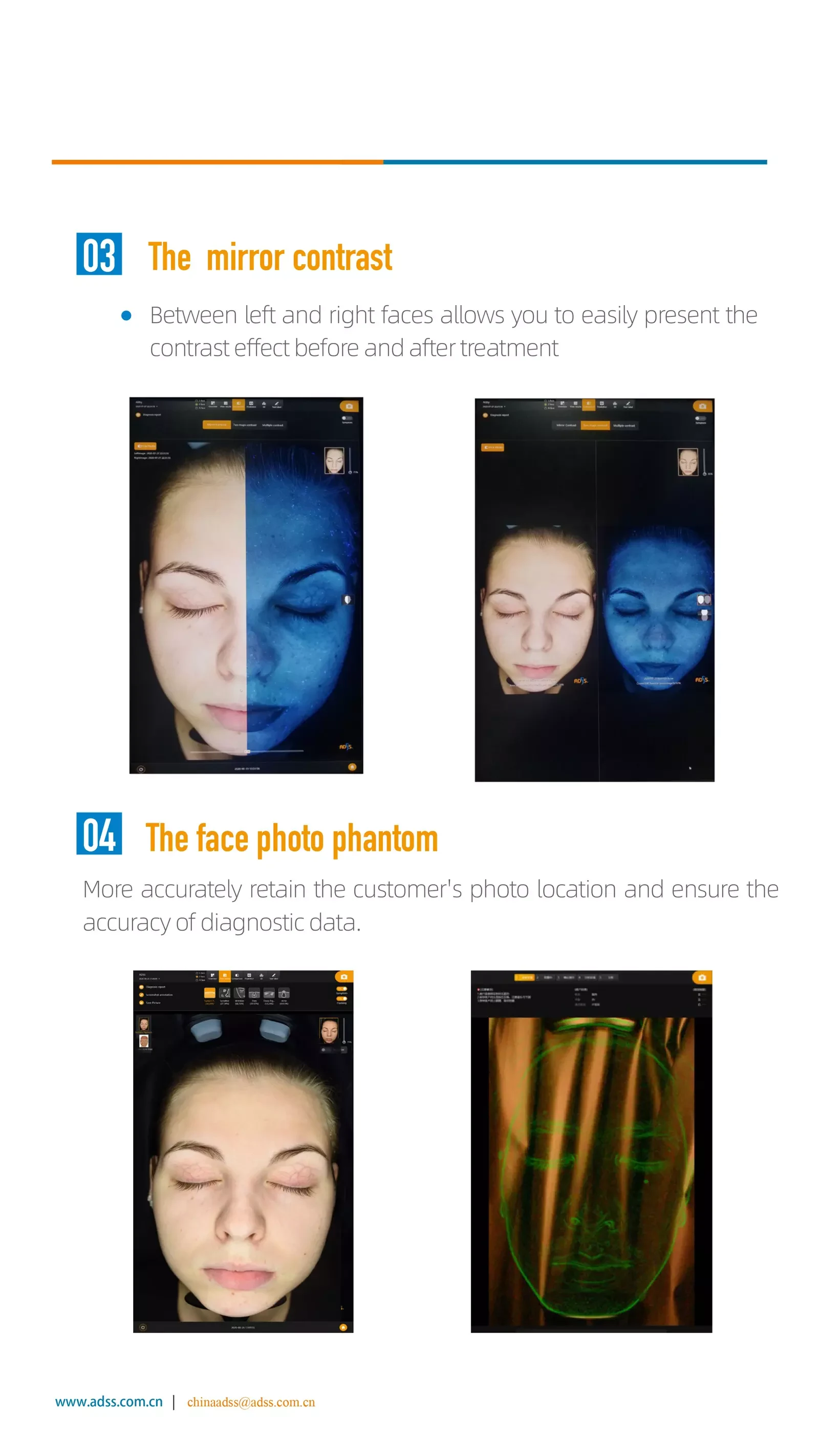 Skin Analyzer Machine
 PDF Download