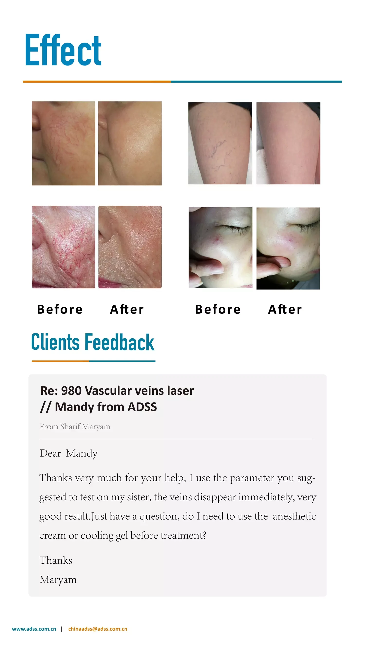 Vascular Removal Machine PDF Download