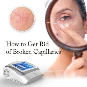 Portable Laser Spider Vein Vascular Removal Machine