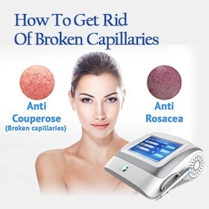 Diode Laser Spider Vein Vascular Removal Equipment