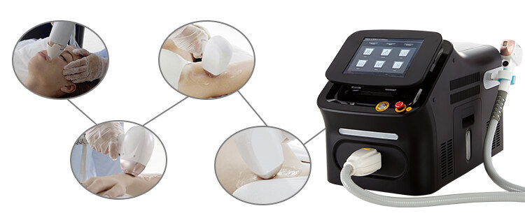 Portable Laser Hair Removal Equipment