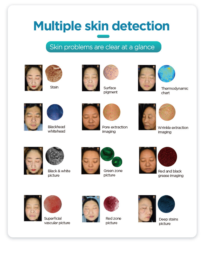 3D Skin Tester Machine 3D Skin Tester Machine