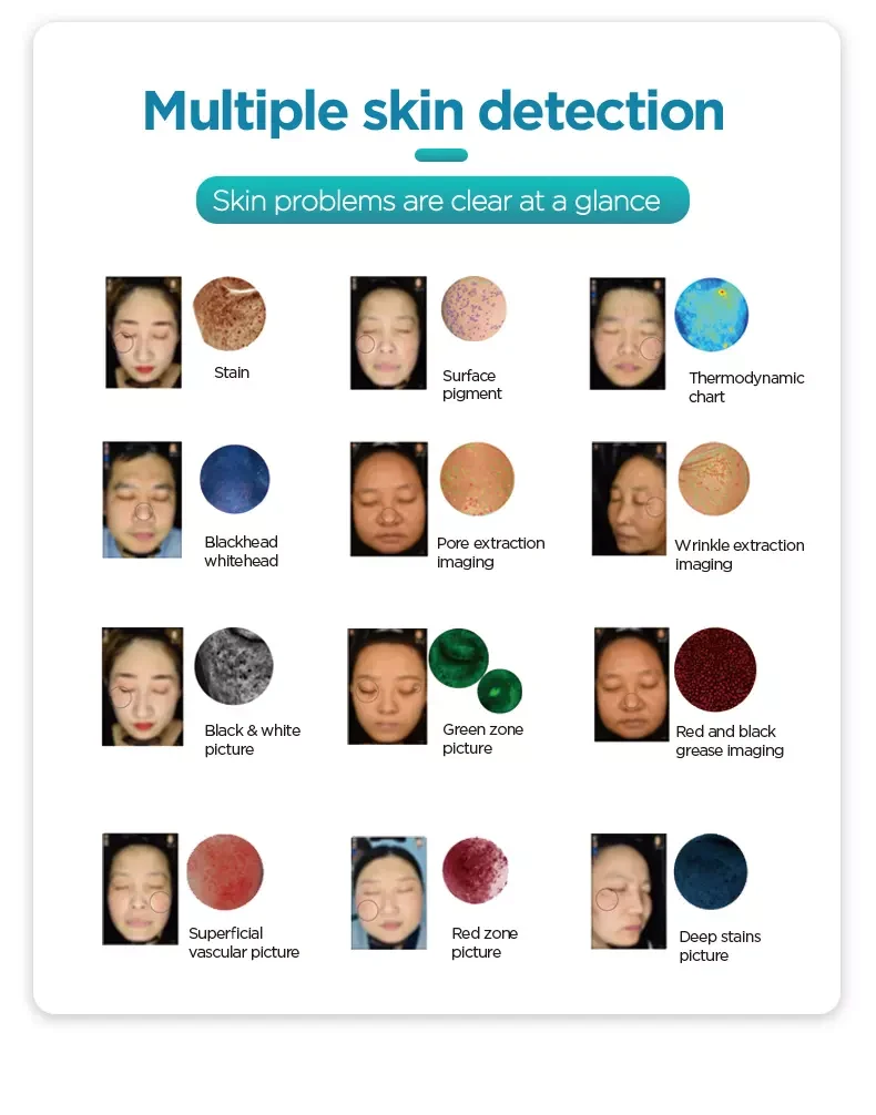3D Skin Analysis Machine for Beauty Salon 3D Skin Analysis Machine for Beauty Salon