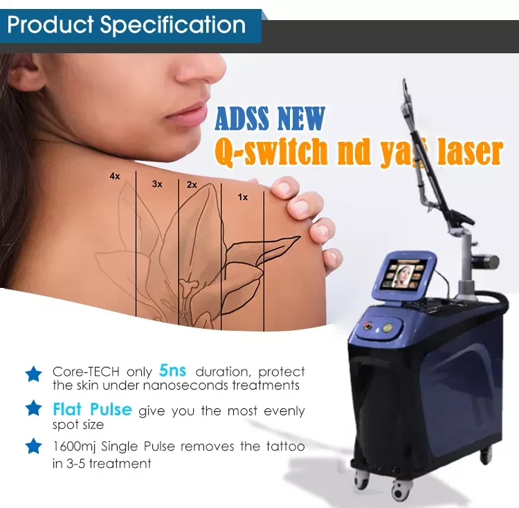 Q-Switched ND YAG Laser Q-Switched ND YAG Laser